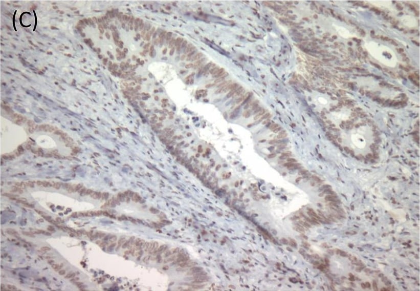 Detection of Human TrkB by Immunocytochemistry/Immunofluorescence