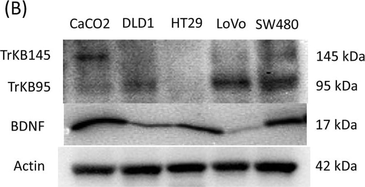 Detection of Human TrkB by Western Blot