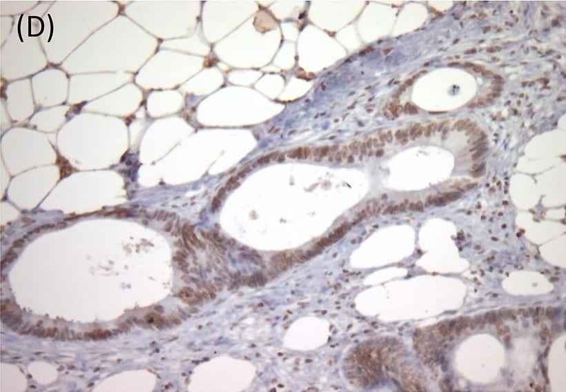 Detection of Human TrkB by Immunocytochemistry/Immunofluorescence