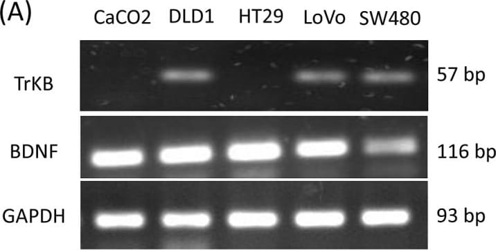 Detection of Human TrkB by Western Blot