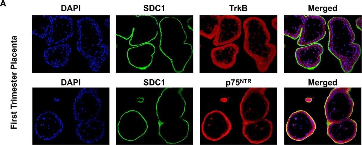 Detection of Human TrkB by Immunohistochemistry