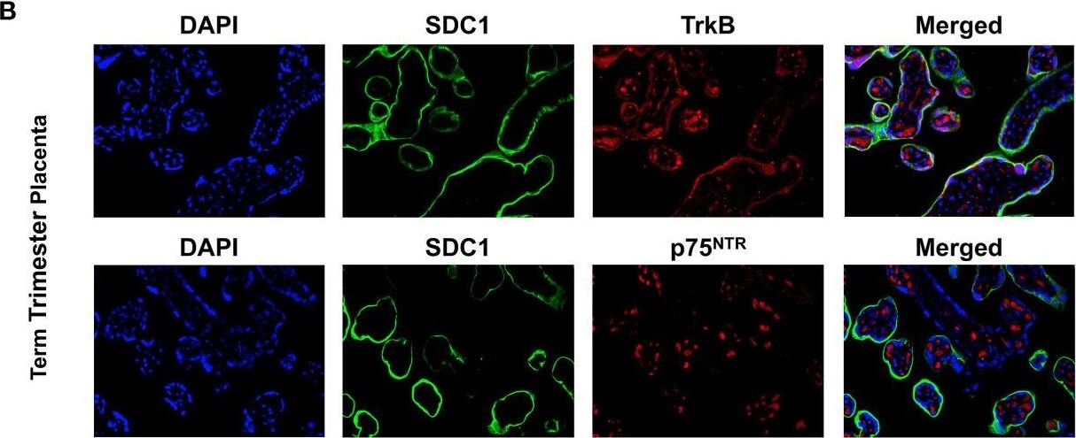 Detection of Human TrkB by Immunohistochemistry