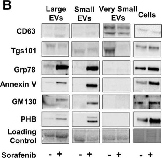 Detection of Annexin V by Western Blot