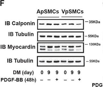 Detection of Myocardin by Western Blot