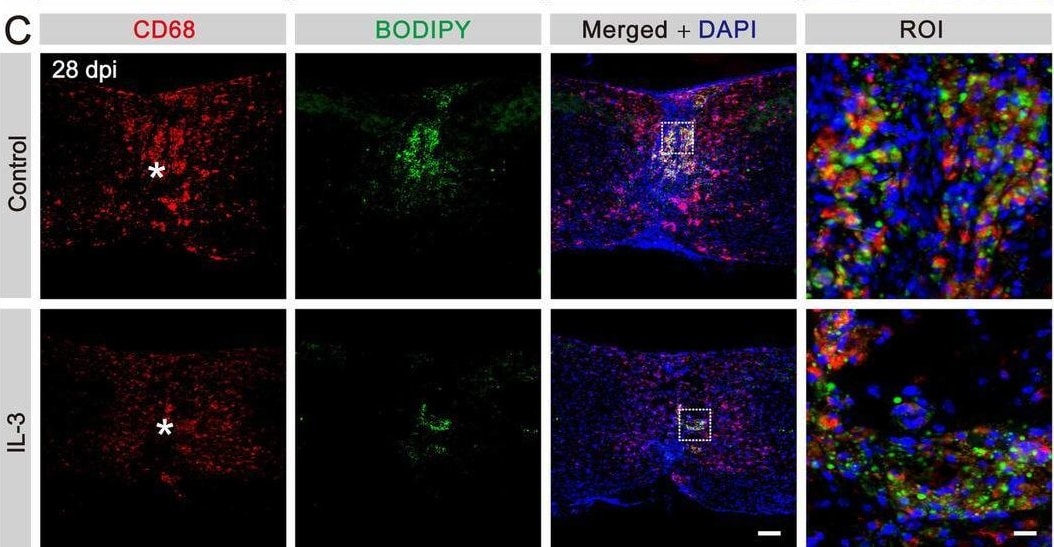 Detection of IL-3 by Immunocytochemistry/ Immunofluorescence