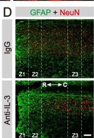 Detection of IL-3 by Immunohistochemistry