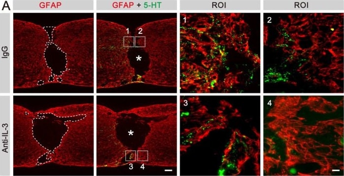 Detection of IL-3 by Immunohistochemistry