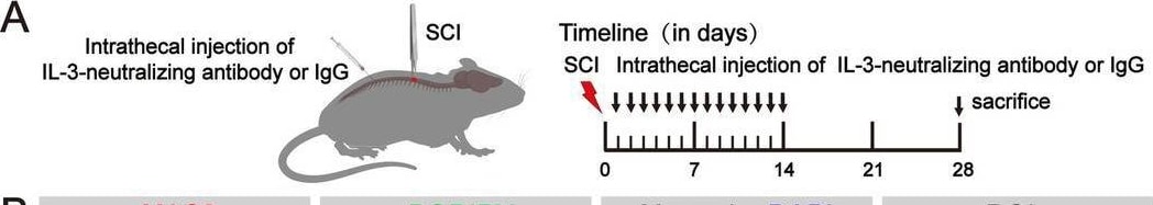 Detection of IL-3 by Western Blot