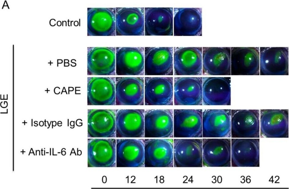 Detection of IL-6 by Immunocytochemistry/ Immunofluorescence