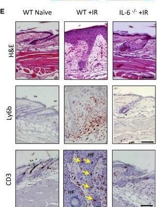 Detection of IL-6 by Immunohistochemistry