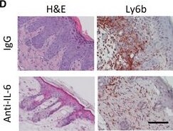 Detection of IL-6 by Immunohistochemistry