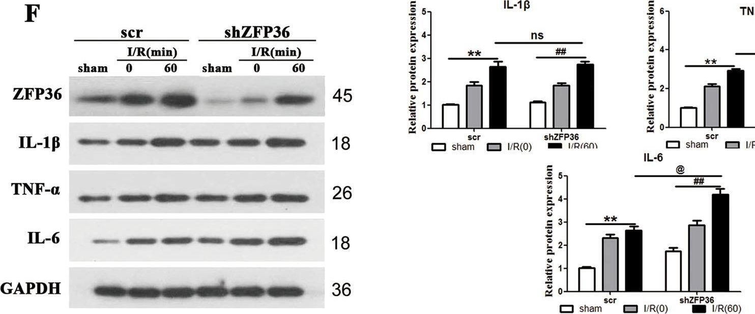 Detection of IL-6 by Western Blot