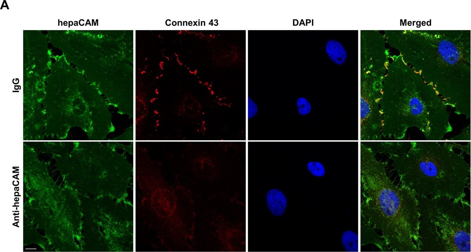 Detection of Human HepaCAM by Immunocytochemistry/Immunofluorescence