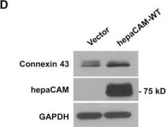 Detection of Human HepaCAM by Western Blot