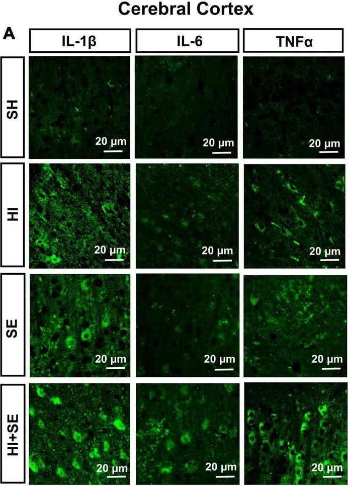Detection of Mouse TNF-alpha by Immunohistochemistry