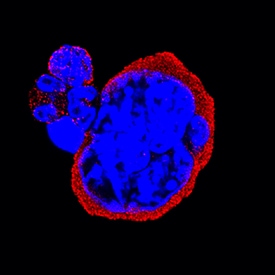Integrin a2b/CD41 antibody in Mouse Bone Marrow Cells by Immunocytochemistry (ICC).