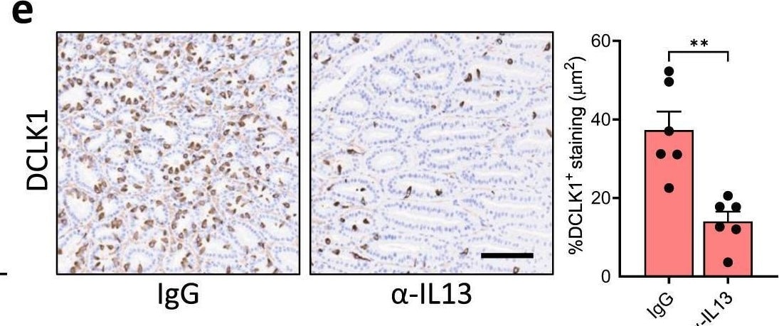 Detection of IL-13 by Immunohistochemistry
