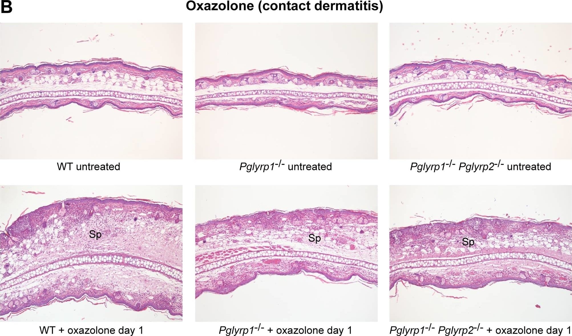 Detection of Mouse IL-17/IL-17A by In vivo assay