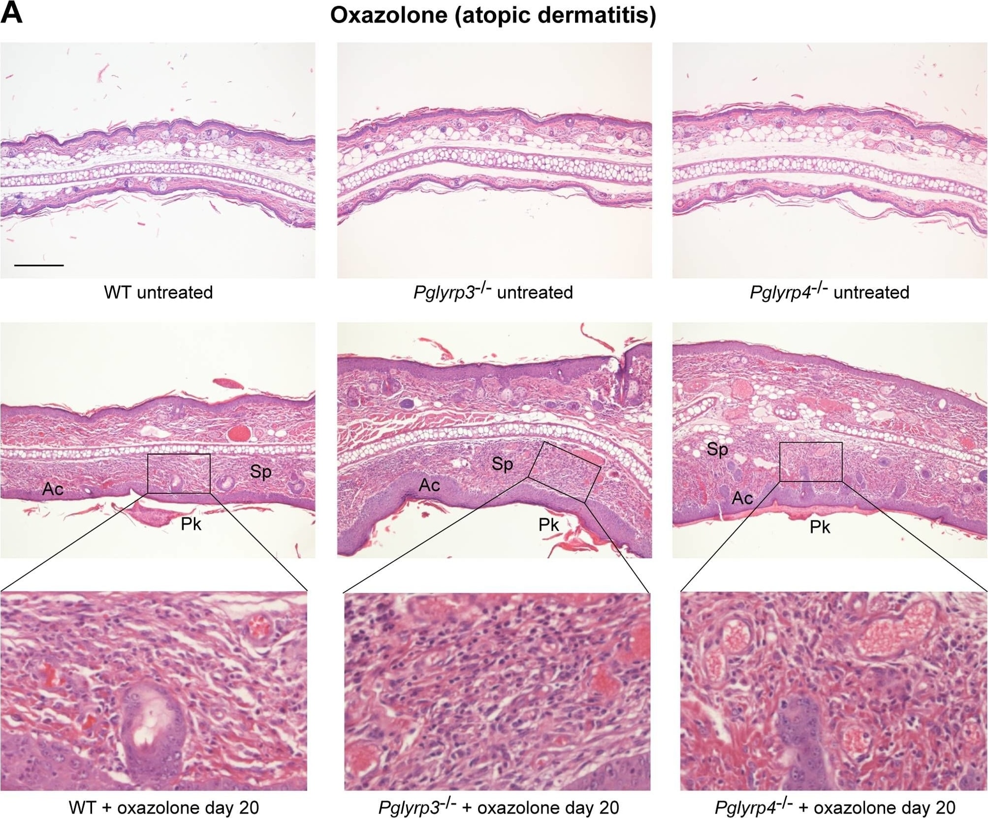 Detection of Mouse IL-17/IL-17A by In vivo assay