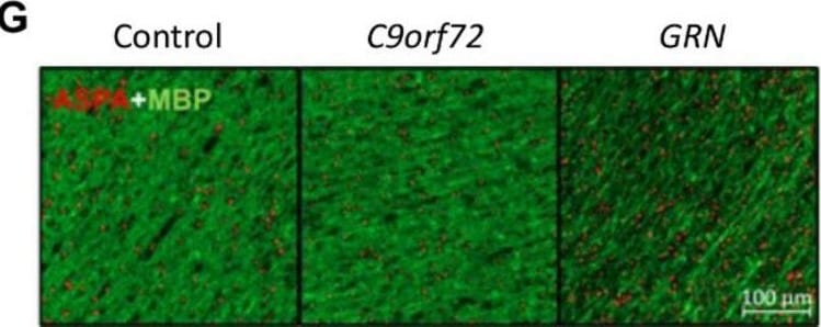 Detection of Human MBP by Immunohistochemistry