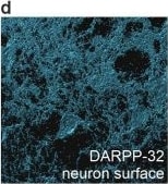 Detection of DARPP-32 by Immunohistochemistry
