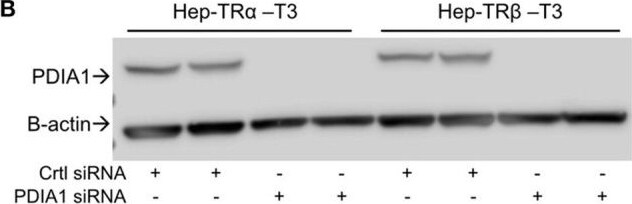 Detection of P4HB by Western Blot
