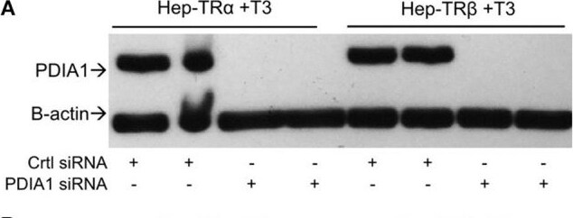 Detection of P4HB by Western Blot