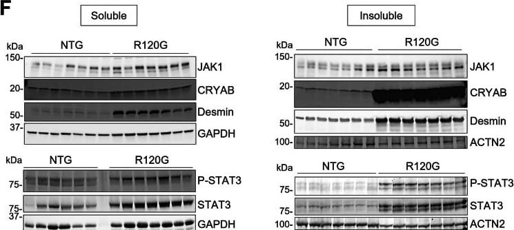 Detection of Jak1 by Western Blot