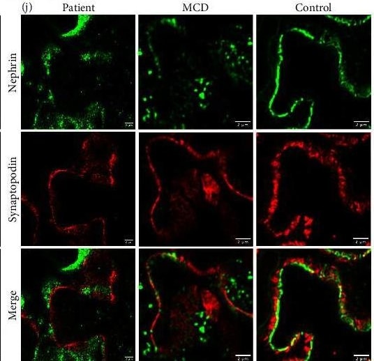 Detection of Nephrin by Immunohistochemistry