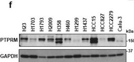 Detection of PTP mu/PTPRM by Western Blot