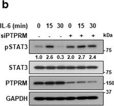 Detection of PTP mu/PTPRM by Western Blot