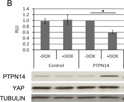 Detection of Human PTPN14/PTPD2 by Western Blot