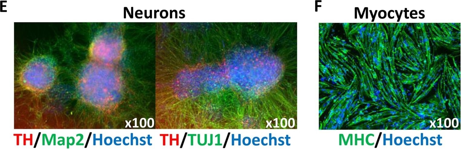 Detection of Human Myosin Heavy Chain Antibody by Immunocytochemistry/ Immunofluorescence