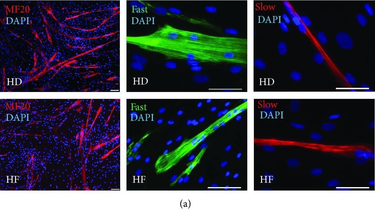 Detection of Human Myosin Heavy Chain by Immunocytochemistry/Immunofluorescence