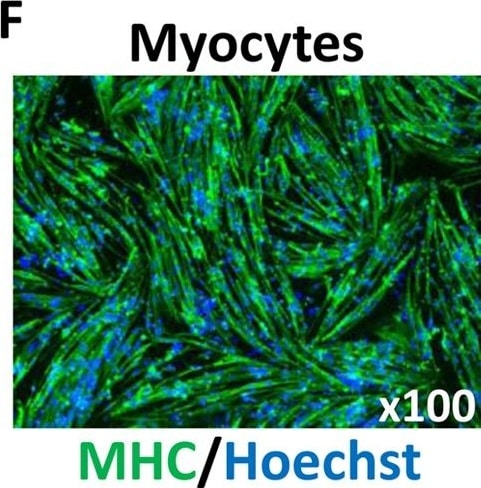 Detection of Human Myosin Heavy Chain by Immunocytochemistry/Immunofluorescence