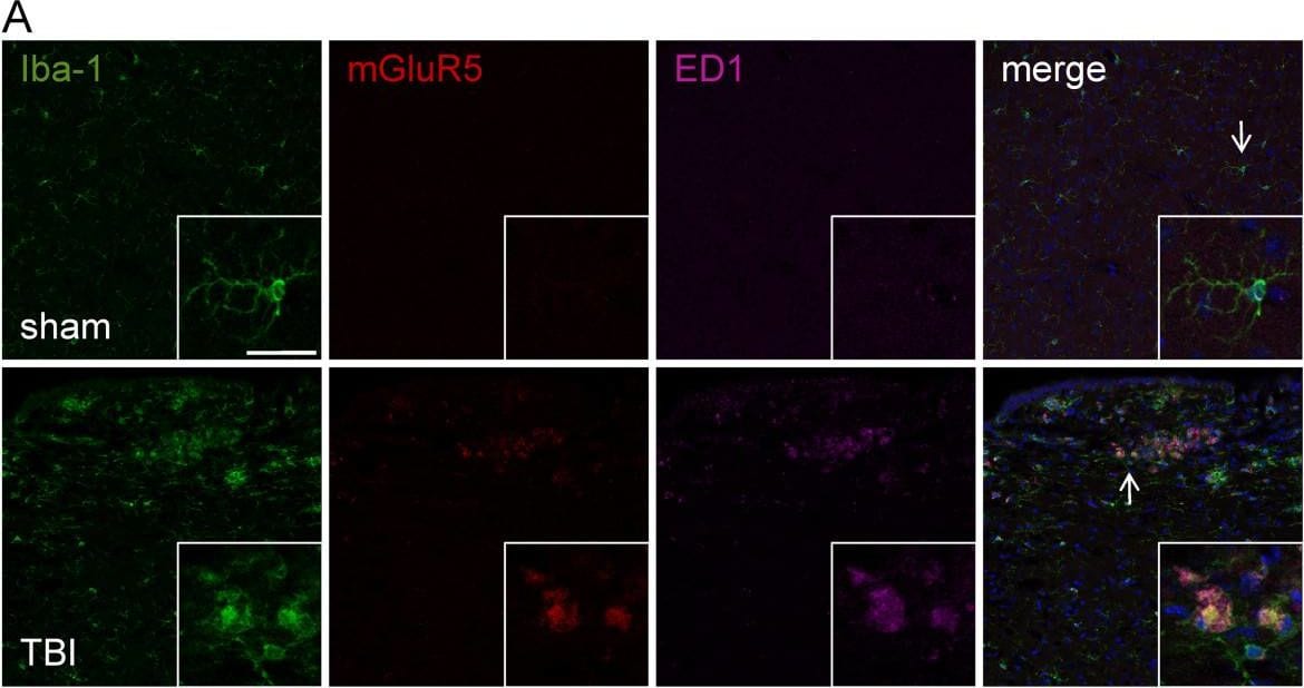 Detection of Mouse mGluR5 by Immunocytochemistry/Immunofluorescence