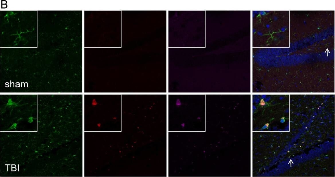 Detection of Human mGluR5 by Immunocytochemistry/Immunofluorescence