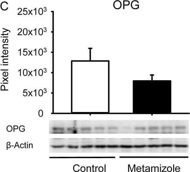 Detection of Osteoprotegerin/TNFRSF11B by Western Blot