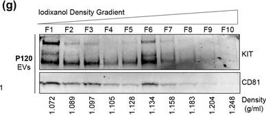 Detection of Human CD81 by Western Blot