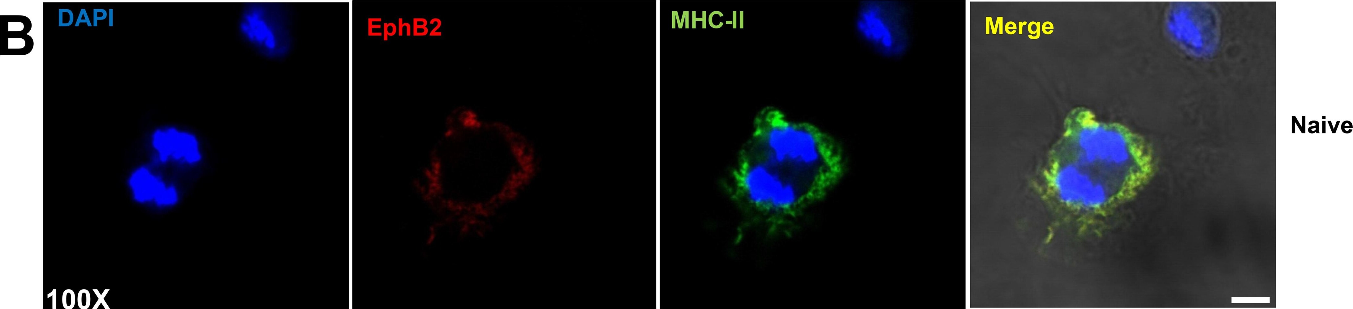 Detection of Mouse EphB2 by Immunocytochemistry/Immunofluorescence