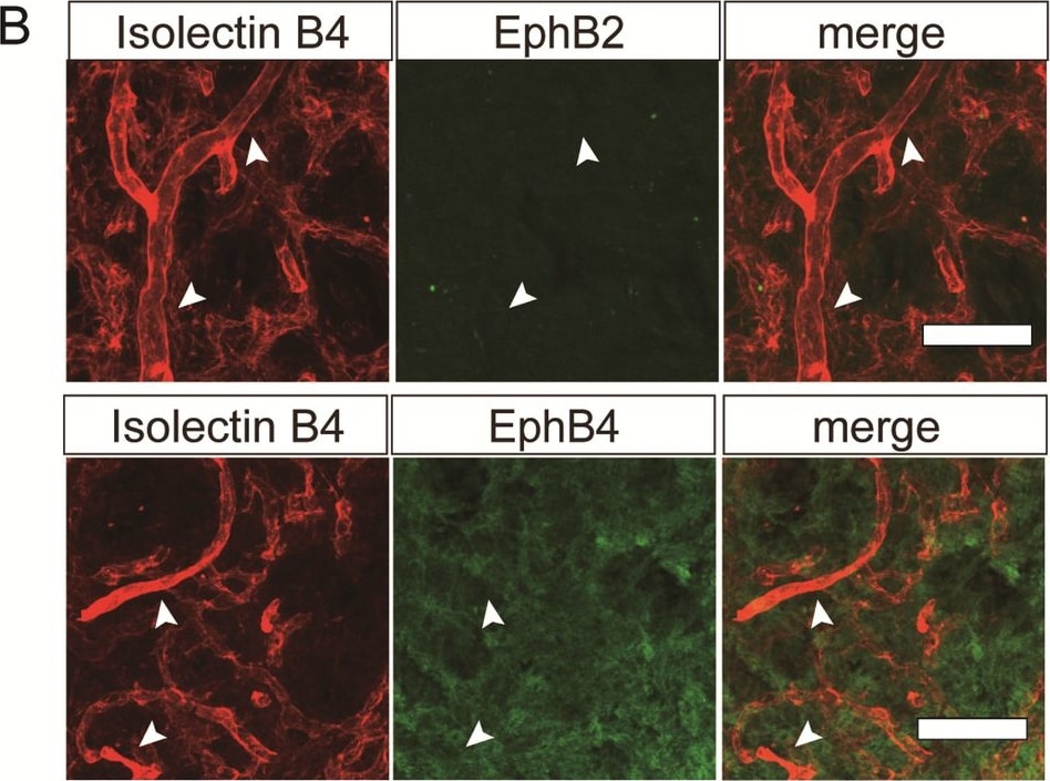Detection of EphB2 by Immunohistochemistry