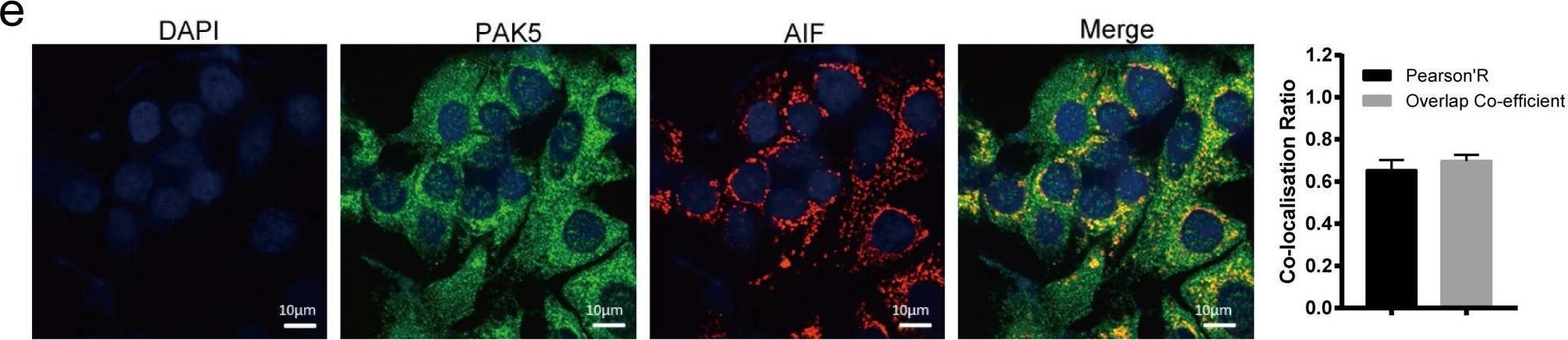 Detection of PAK7 by Immunohistochemistry