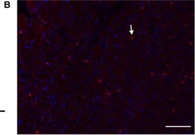 Detection of Mouse CD3 by Immunocytochemistry/Immunofluorescence