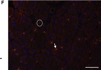 Detection of Mouse CD3 by Immunocytochemistry/Immunofluorescence