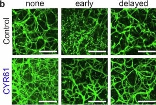 Detection of Cyr61/CCN1 by Immunocytochemistry/ Immunofluorescence