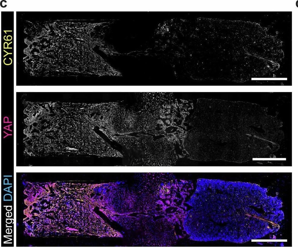 Detection of Cyr61/CCN1 by Immunohistochemistry