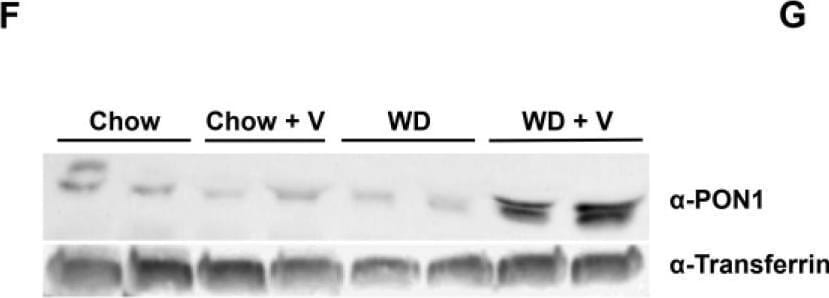 Detection of PON1 by Western Blot