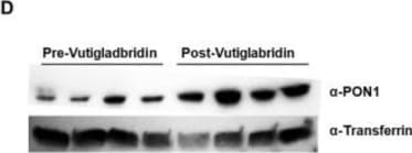 Detection of PON1 by Western Blot