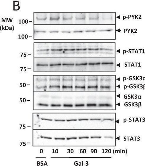Detection of Phospho-STAT3 (S727) by Western Blot