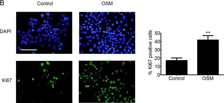 Detection of Oncostatin M (OSM) by Immunocytochemistry/ Immunofluorescence